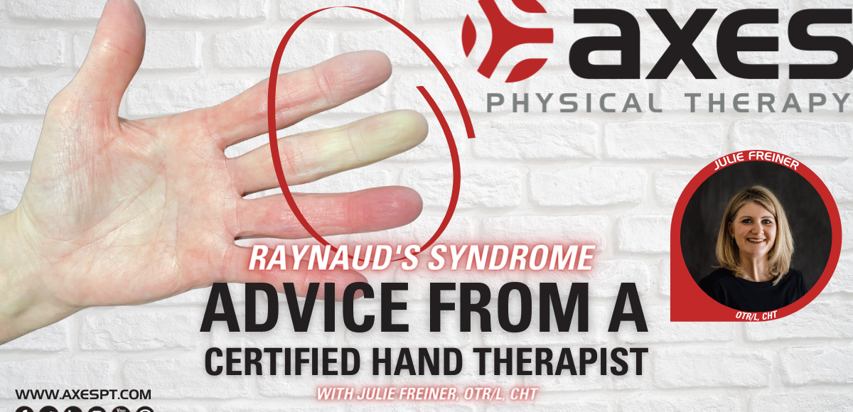 raynauds syndrome